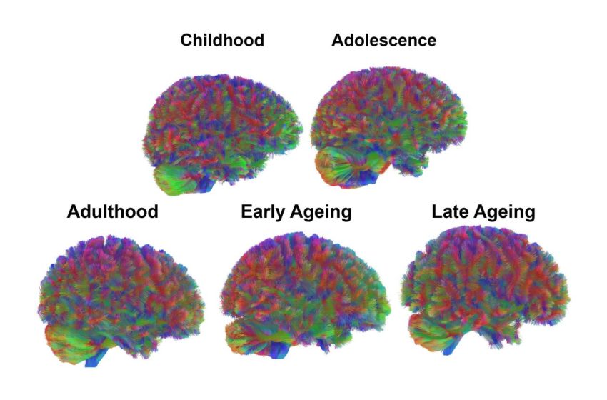 الأعمار الخمسة لأدمغتنا